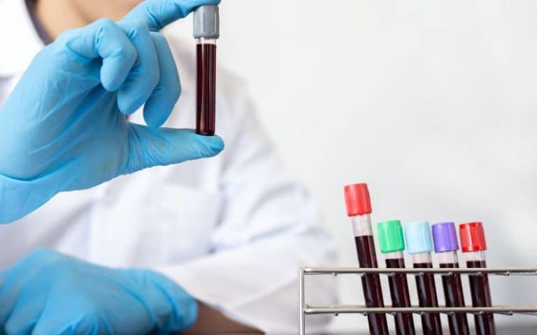 Should You Do Cycling After A Blood Test? (Explained)